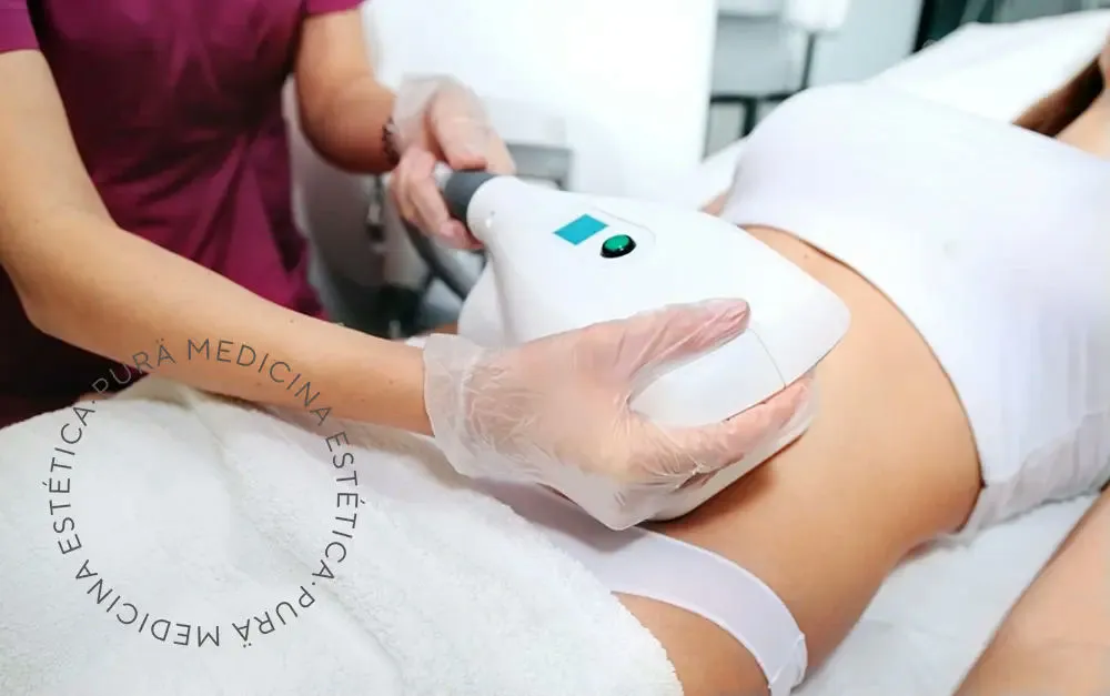 CoolSculpting: Innovación Estética a Precio Accesible en Málaga y Rincón de la Victoria