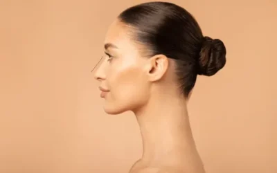 Micropigmentación capilar: Precisión y tecnología para recuperar la densidad